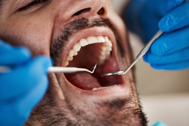 Best Emergency Root Canal Treatment in Petersburg, MI