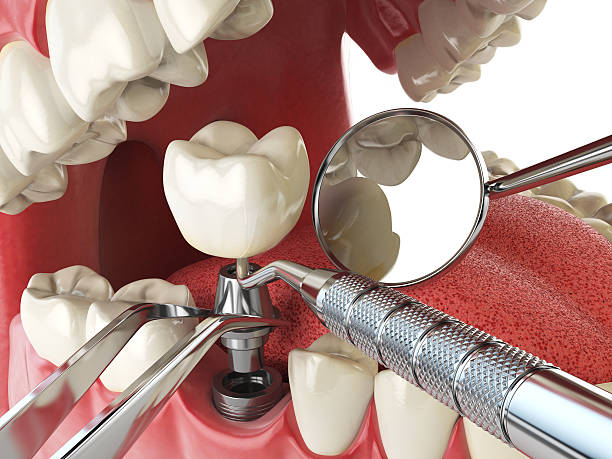 Best Emergency Orthodontic Repairs in Petersburg, MI