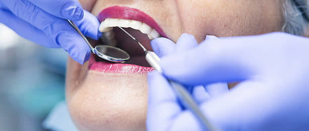Best Emergency Broken Tooth Repair in Petersburg, MI
